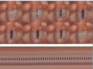 Figure 2. Top: Clipping of one vibration period from a high- high-speed recorded sequence of male healthy vocal folds.