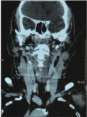 Fig. 2 Magnetic resonance image.