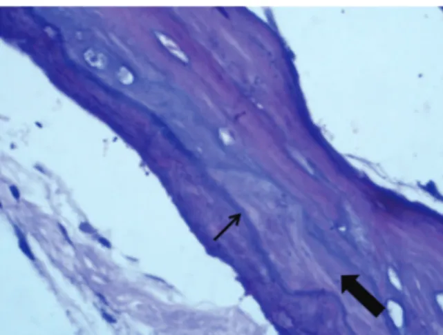 Fig. 2 Comparison between stapes superstructure (OTS) in patients with otosclerosis and control (CONTROL).