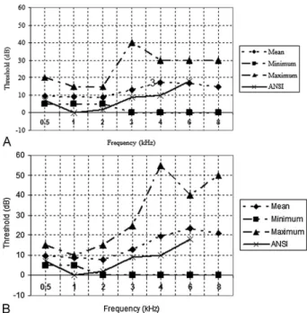 Fig. 2 Mean, minimum, and maximum value of hearing thresholds in right ear (A) and left ear (B) of the group that showed noise level ranging from 85 to 89.9 decibels with A-weighting ﬁ lter (dBA) per  8-hour exposure daily with conversion factor of 5 dBA (