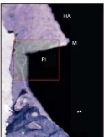Figura 8 – Vista histológica da amostra em              Figura 9 – Vista histológica da área da plataforma
