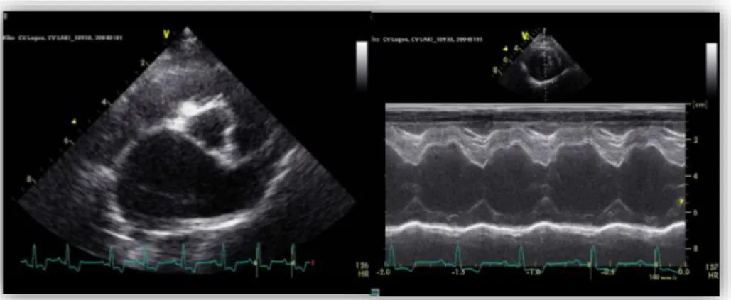 Figura 1 – Ecocardiografia em modo B e M mostrando dilatação ventricular  esquerda de um canídeo com insuficiência valvular mitral 