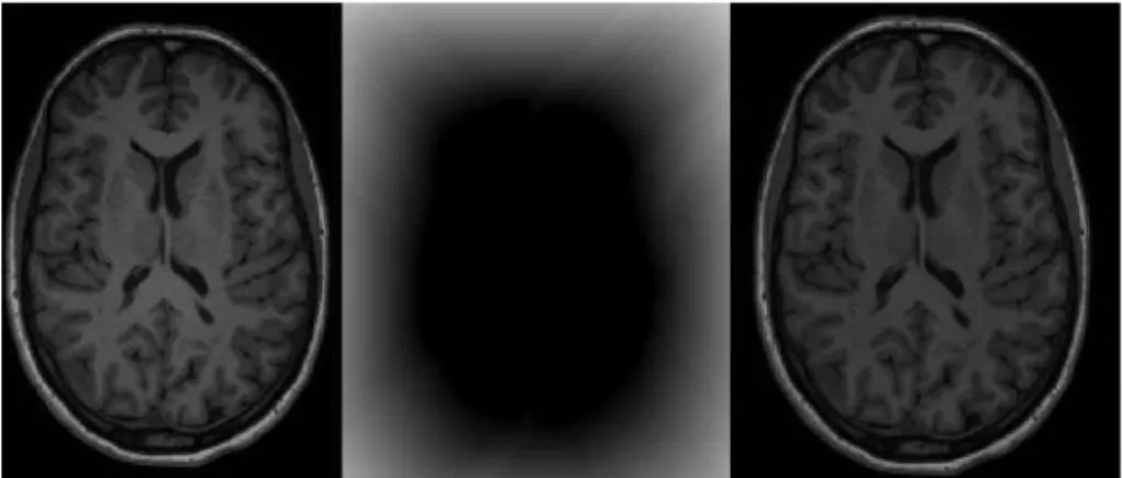Figure 2.3: Example of bias field correction. On the left it is shown a T1- T1-weighted image with presence of bias field (grey matter can be seen with different intensities in the left and right side of the image); the centre represents the bias field and