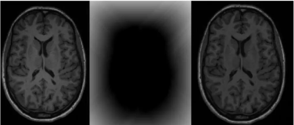 Figure 2.3: Example of bias field correction. On the left it is shown a T1- T1-weighted image with presence of bias field (grey matter can be seen with different intensities in the left and right side of the image); the centre represents the bias field and