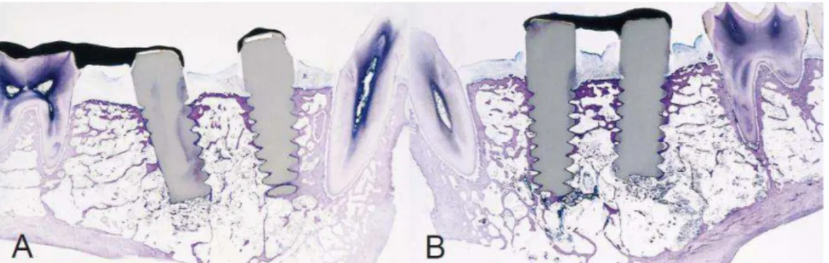 Figura  7  –  Corte  histológico  do  osso  ao  redor  do  implante  na  observação  de  4  e  24  meses;  (a)  Estruturas  unitária  e  implanto-dento  suportada,  (B)  Estrutura  implantossuportada  unida