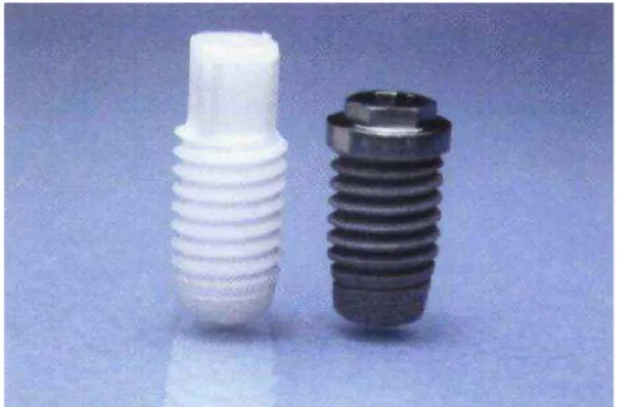 Figura 11  – Um implante de zircônia e um implante de titânio.  Fonte: SENNERBY e cols., 2005