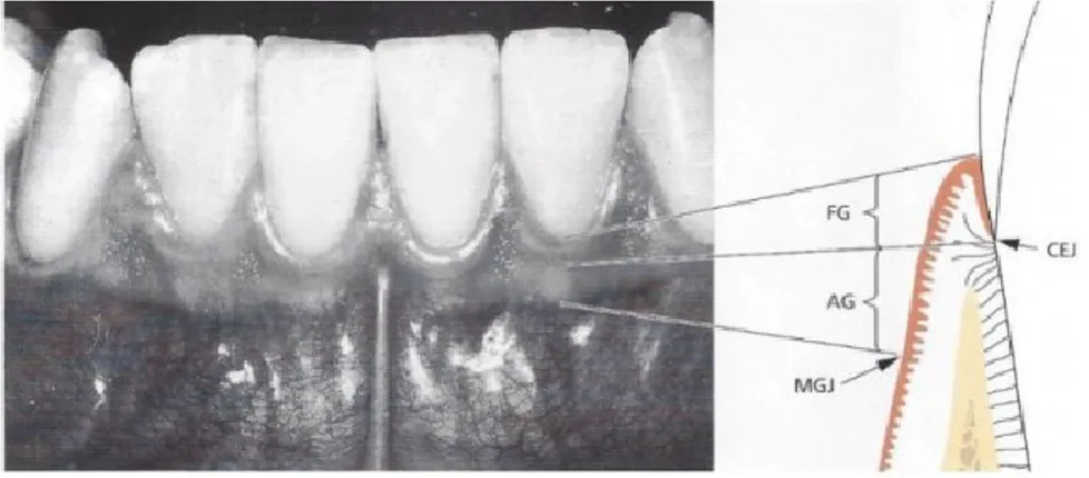 Figura  1-  Constituintes  do  periodonto:  FG-  gengiva  livre,  AG-  gengiva  aderida,  CEJ-  junção  amelocementária, MGJ- junção mucogengival (Adaptada de Lindhe, 2005).