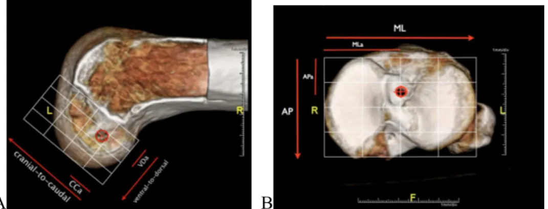 FIGURA 4 – Definição do centro da origem femoral (A) e tibial (B) do LCA  durante a análise tomográfica