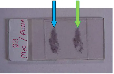FIGURA 9 - Lâmina preparada para análise imunoistoquímica. À esquerda,  identificação que foi recoberta durante toda a contagem no microscópio