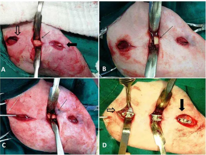 Figura 1: Imagens fotográficas do procedimento cirúrgico para colocação da placa em ponte associada ao pino intramedular  (grupo  I):  A)  abordagem  cirúrgica  com  exposição  do  fêmur  (seta  fina),  incisão  proximal  (seta  vazia),  incisão  distal  (