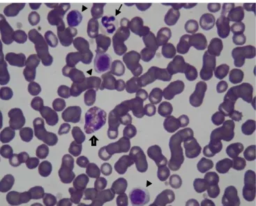 Figura  1-  Esfregaço  de  sangue  de  canídeo.  Presença  de  rouleaux,  neutrófilo  (seta  fina),  eosinófilo  (seta  larga)  e  linfócitos  (pontas  de  setas)