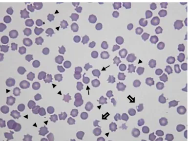 Figura  3-  Esfregaço  de  sangue  de  felídeo.  Presença  de  dacriócitos  (setas  finas),  queratócitos  (setas  largas)  e  acantócitos  (pontas  de  setas)