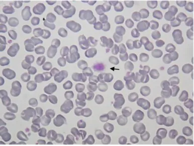 Figura 6- Esfregaço de sangue de canídeo. Presença de  leptócitos e macroplaqueta (seta)