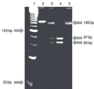 Figure 1 Electrophoresis in a 10% polyacrylamide gel. Lane 1, ladder 25 bp; lane 2, PCR product without digestion (194 bp); lane 3, genotype CT; lane 4, genotype CC; lane 5, genotype TT