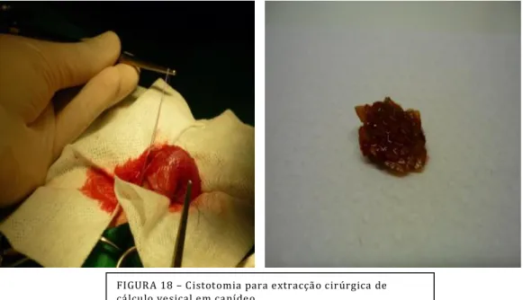 FIGURA 18 – Cistotomia para extracção cirúrgica de  cálculo vesical em canídeo  