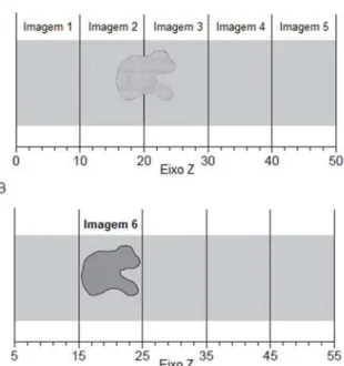 Figura 18 – Ilustração do efeito de volume parcial. A) Contraste  reduzido da lesão na periferia das imagens 2 e 3