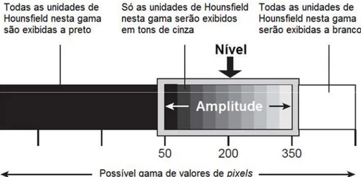 Figura 21 – O software atribui tons de cinza para os valores de Hounsfield que se encontram dentro do nível selecionado