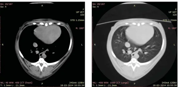 Figura 22 – Efeito da janelização na representação das imagens tomográficas. À esquerda: janela de tecidos moles