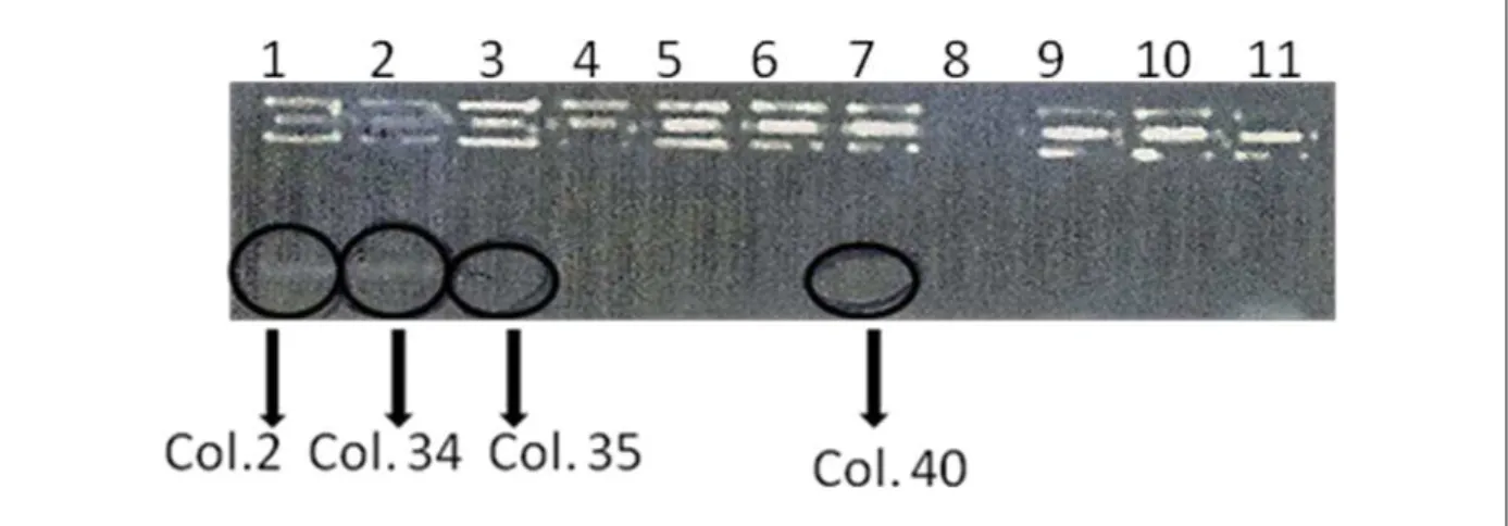 Figura  16  –  PCR  de  colônia  usando  os  iniciadores  Dib-ext  direto+  His  reverso (E+L) e o par de iniciadores His direto e His reverso (His) apresentado  em gel de agarose 0.8% corado por brometo de etídeo