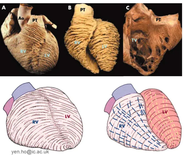 FIGURA 2  – Ventrículo Direito: visão das fibras musculares 