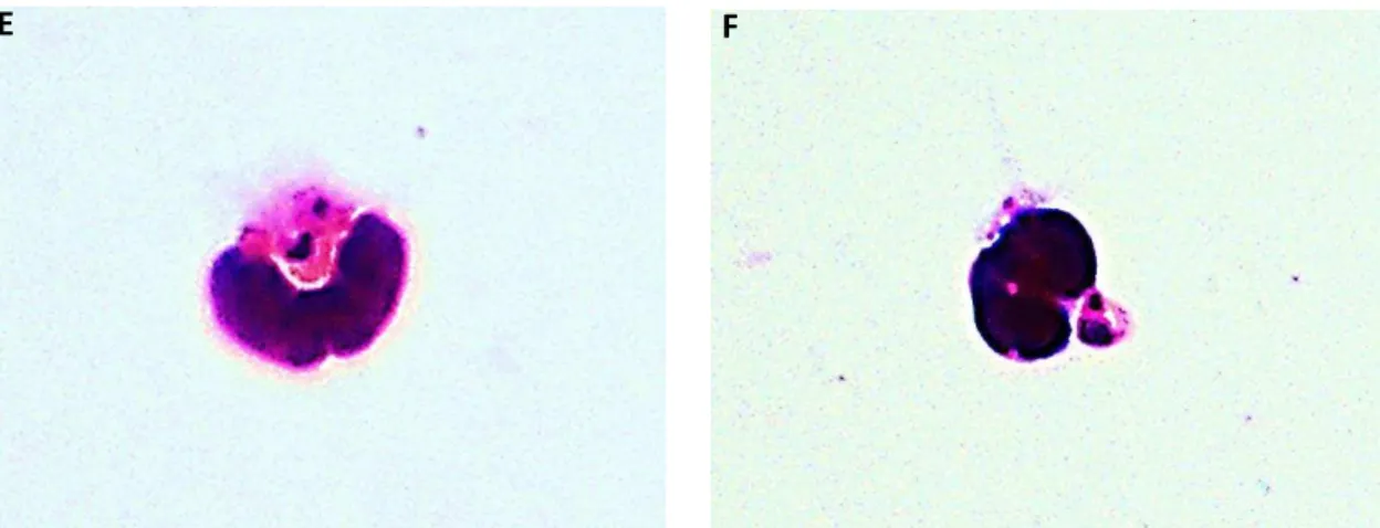 Figura 6: Monócitos CD14 hi SSC lo  e CD14 lo SSC lo  apresentaram capacidade fagocítica de formas promastigotas 