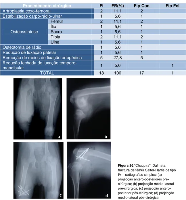 Figura 26:”Chaquira”, Dálmata,  fractura de fémur Salter-Harris de tipo  IV – radiografias simples: (a)  projecção antero-posteriores  pré-cirúrgica; (b) projecção médio-lateral  pré-cirúrgica; (c) projecção  antero-posterior pós-cirúrgica; (d) projecção  