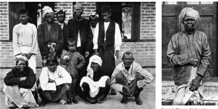 Figure 5: Lepers in the Mandalay Asylum  representing seven nationalities