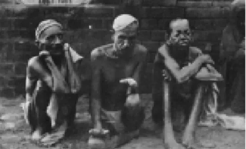 Figure 9: Lepers at the Tarn Taran Asylum