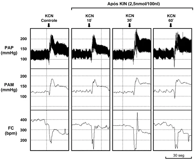 Figura 01 -  Traçado de um rato, representativo do grupo estudado, mostrando as alterações na  pressão arterial pulsátil (PAP, mmHg), pressão arterial média (PAM, mmHg) e freqüência cardíaca (FC, 
