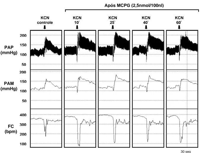 Figura 09 -  Traçado de um rato, representativo do grupo estudado, mostrando as alterações na  pressão arterial pulsátil (PAP, mmHg), pressão arterial média (PAM, mmHg) e freqüência cardíaca (FC, 