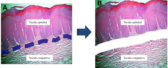Figura  5:  Representação  da  microdissecção  do  tecido.  A)  Separação  do  epitélio  e  do  tecido conjuntivo com caneta permanente; B) Separação dos fragmentos após secção do  tecido