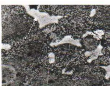 Figura VII - a): Micrografia do metal base da liga de Au: P=precipitado:  Aumento: 1000X 