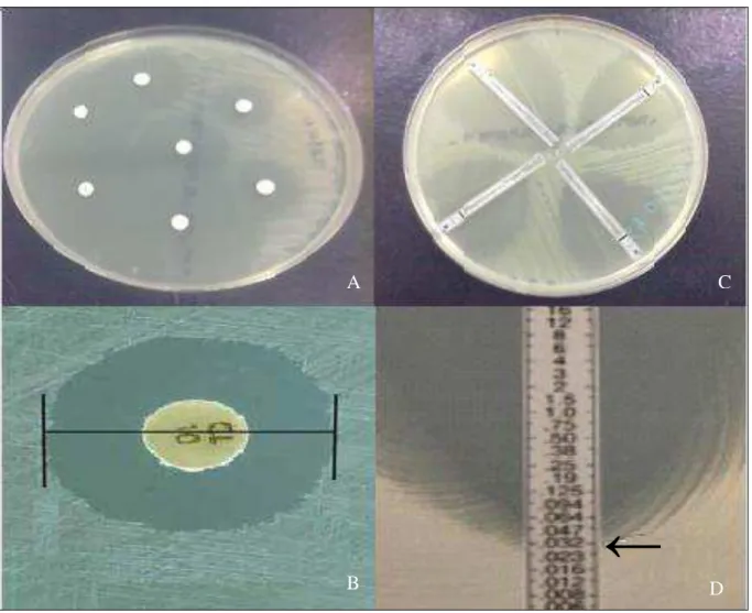 Figura 10  - Testes de susceptibilidade a antimicrobianos. A- Difusão em disco; B- Etest; C- Leitura do 
