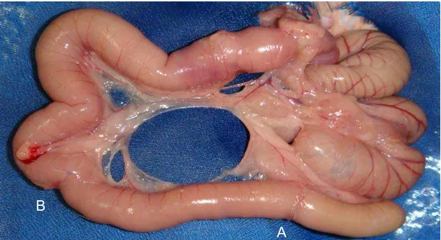 Figura 9 - Segmento intestinal contendo o esfíncter proximal (A) e o esfíncter  distal (B) do grupo B no dia da eutanásia 