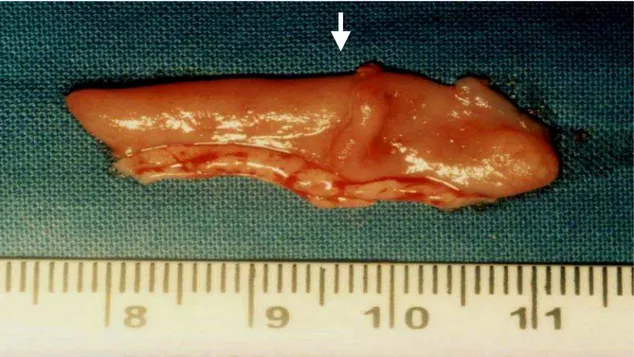 Figura 11 - Apresentação do esfíncter na face mucosa de peça do animal do  grupo C (seta)