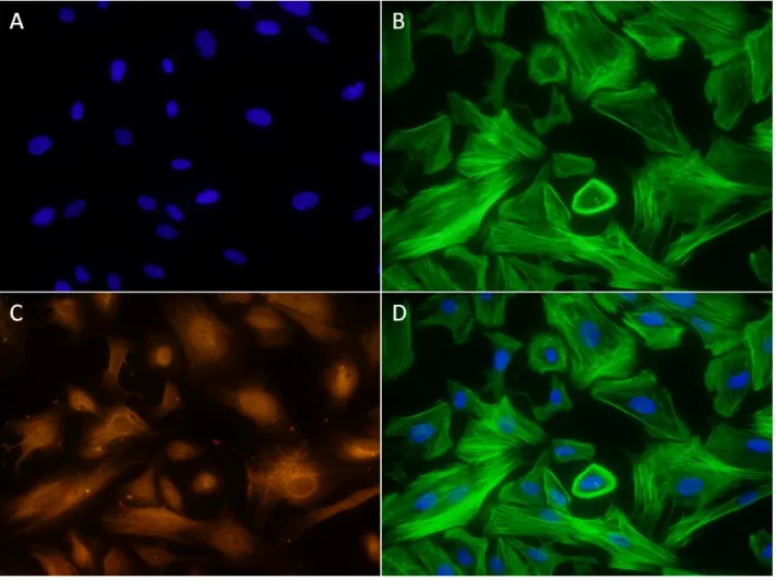 FIGURA  3  -  Marcação  imunofluorescente  para  células  estromais  endometriais.  A