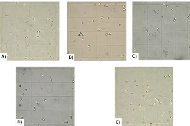 Figura 15 - Aparência microscópica das co-culturas. A) Co-cultura de S. cerevisiae S-04 e D