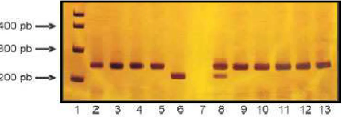 Figura 8 – Fator V Leiden. Fragmentos obtidos após realização da PCR e digestão  com endonucleases de restricão