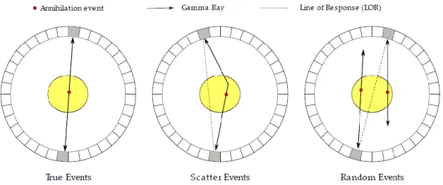 Figure 2.2 - Different types of coincidences: Left) True event; Centre) Scatter event; Right) Random event (Weirich 