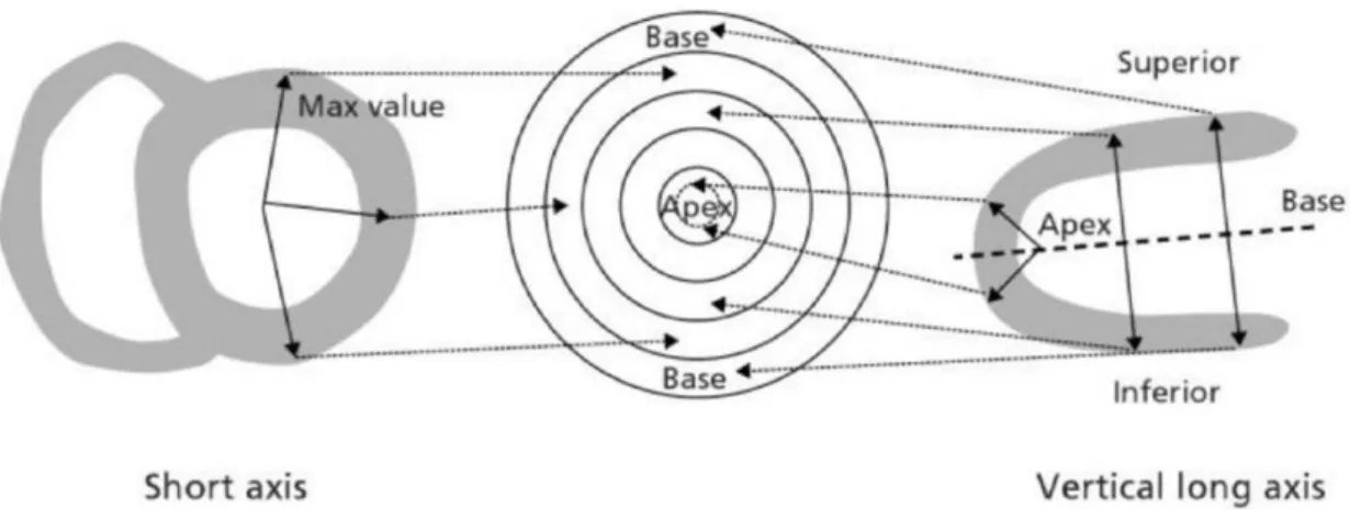 Figure 2.10 - General relationship between LV 17 segment model and myocardial regions (Groch &amp; Erwin, 2001)