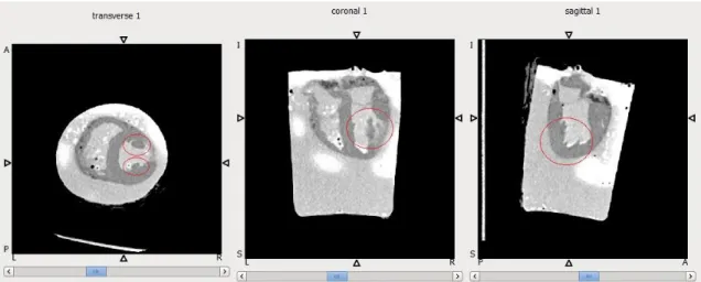Figure 5.10 - Apical location of excised dog heart #2 - all 3 reference views 