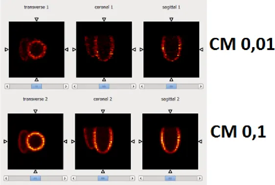 Figure 5.14 - OSEM reconstructions of model images with initial voxel intensities of 0.01 (top) and 0.1 (bottom) - all  3 reference views 