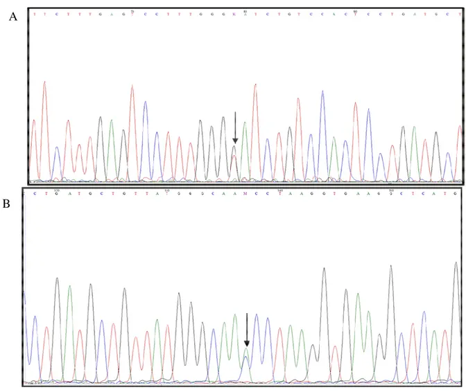 Figura 1- Eletroforegrama correspondente ao sequenciamento do éxon 2 do gene HBB.  A-  Sequência  de  DNA  de  uma  das  crianças  que  possui  a  mutação  GAT&gt;TAT  em  heterozigose no códon 47 (seta), a qual resulta em Hb Maputo