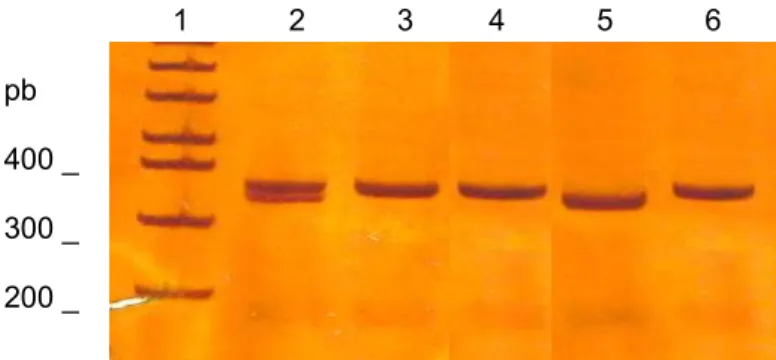 Figura 7 -  Digestão dos produtos de PCR da protrombina, para o diagnóstico da mutação  G20210A em mulheres do grupo controle e em uso de TH.