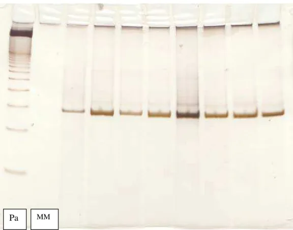 Figura 8: gel de poliacrilamida com produtos de PCR do exon 11 da TPH2. 