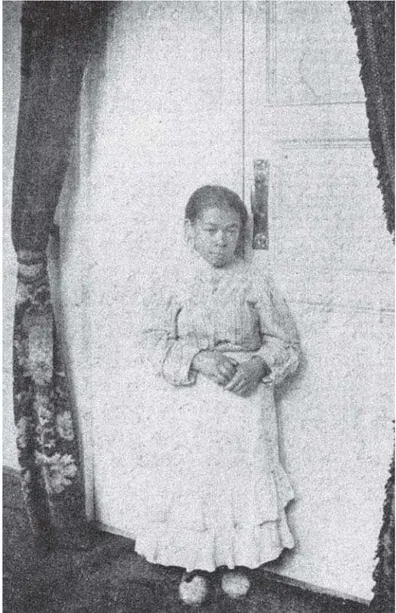 Figura 4: Clotilde N., caso de infantilismo con puerilismo mental, descrito por Luis Felipe Calderón (1913)Al estudiar al cuerpo sometido a los