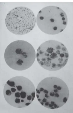 Figure 6: Cultures of ‘hypnococcus’ in agar, better viewed in plates 3 and 4 (Bettencourt et al., 1901, p.333)