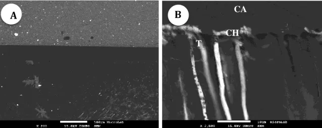 Fig.  9-  Micrografias  FEG-SEM  da  interface  resina-dentina  com  CSE-E.D.  Ampliação  final:  A