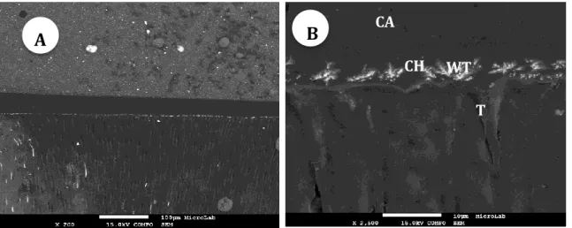 Fig. 12- Micrografias FEG-SEM da interface resina-dentina com SBU+SM-E.D. 