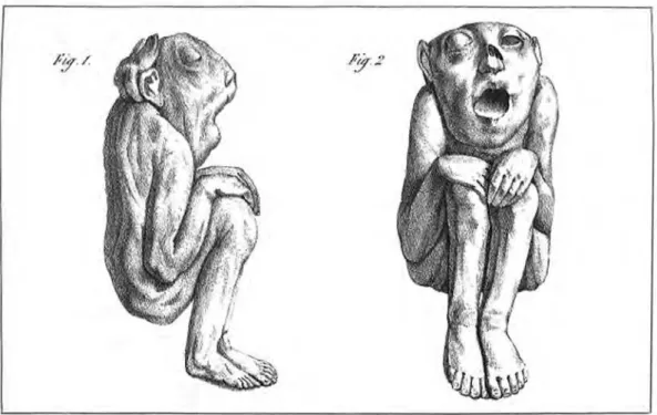 Figura 1: Momias anencefálicas (Saint-Hilaire, 1837, plancha 9) 